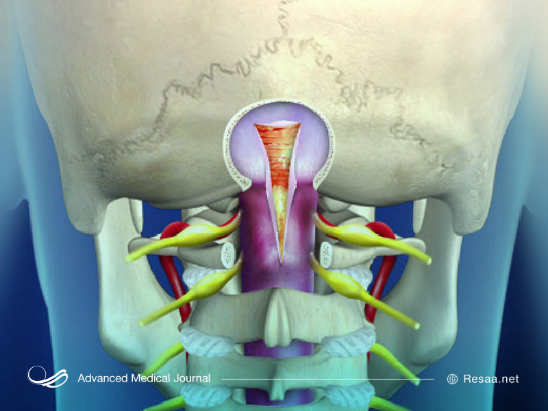 علایم کیاری