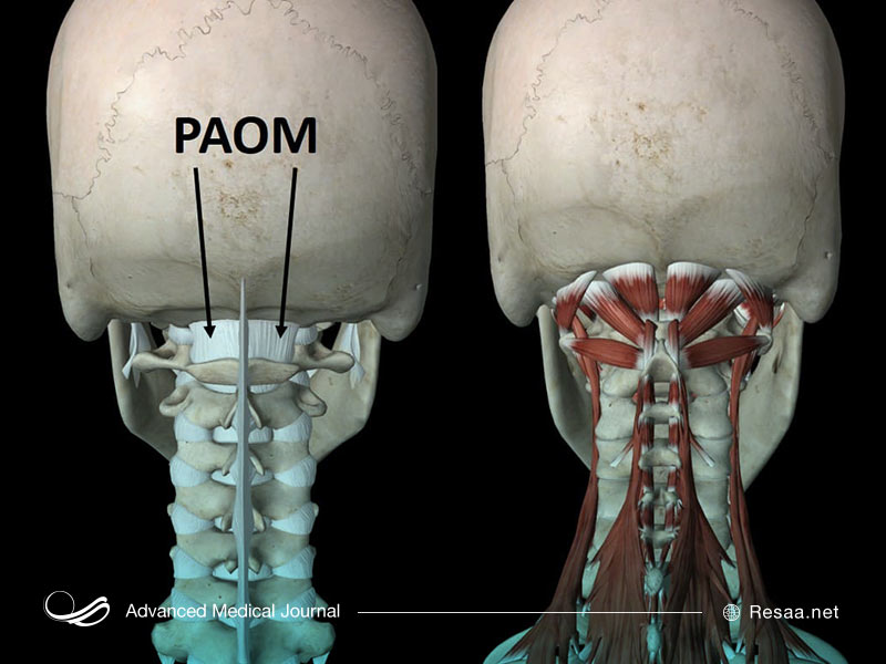 بیماری مرتبط با مغز