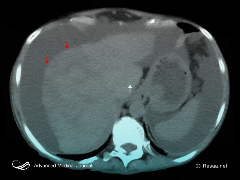 تصویر برداری از مغز