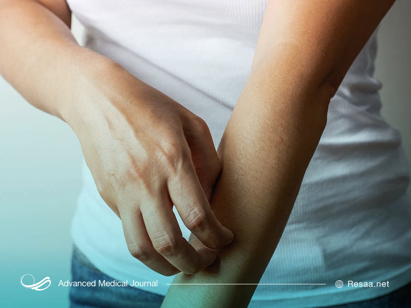 بثورات پوستی در کرونا