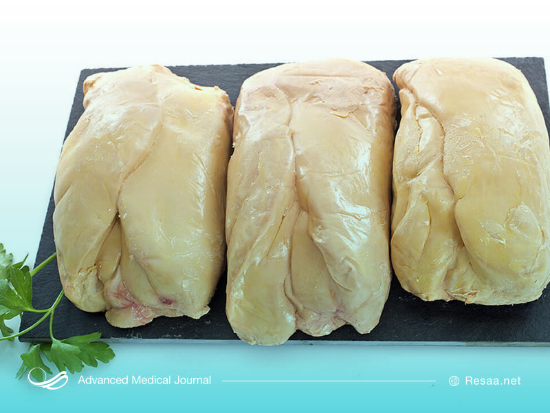 بزرگ شدن کبد