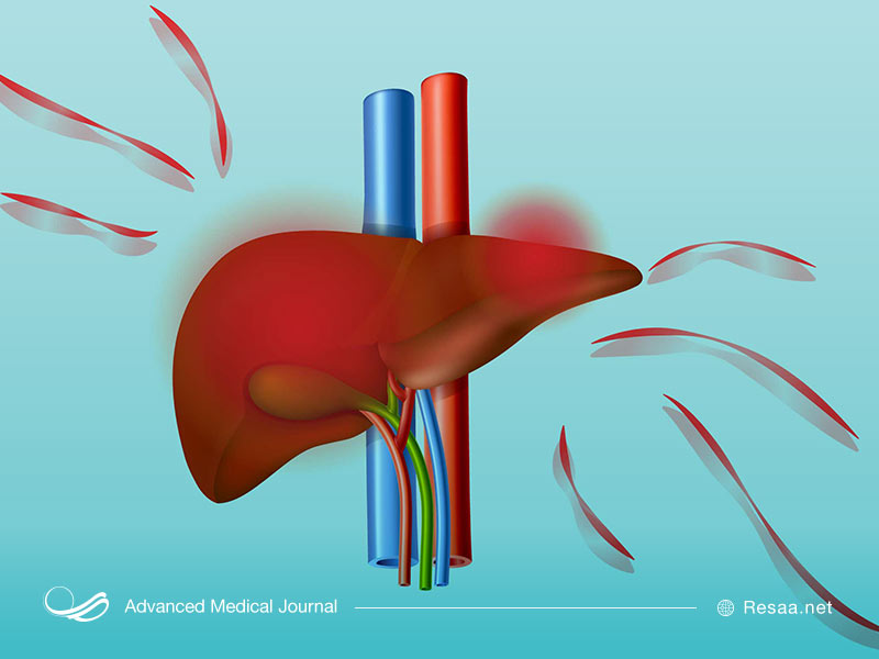 تشخیص بزرگ شدن کبد