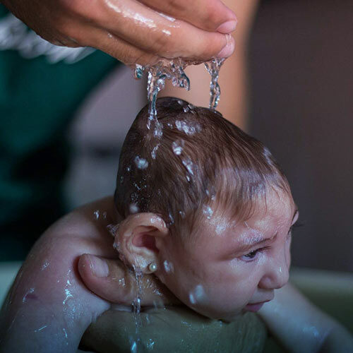 میکروسفالی و علل بروز آن