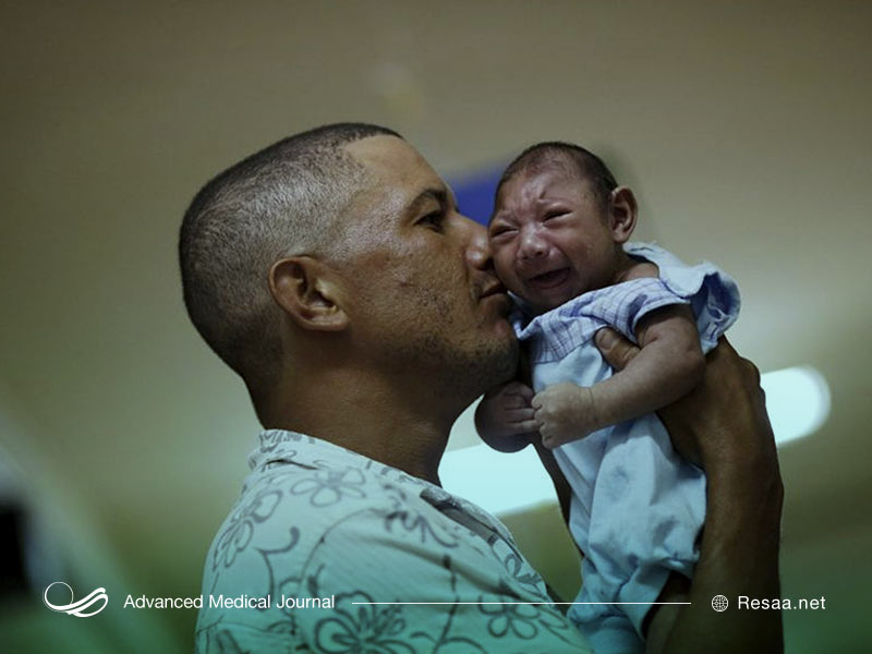 سندروم Cornelia de Lange