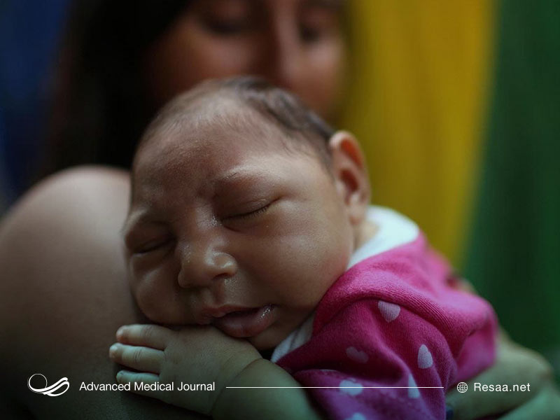 سرخچه هم مادرزادی میتواند سبب بروز میکروسفالی شود