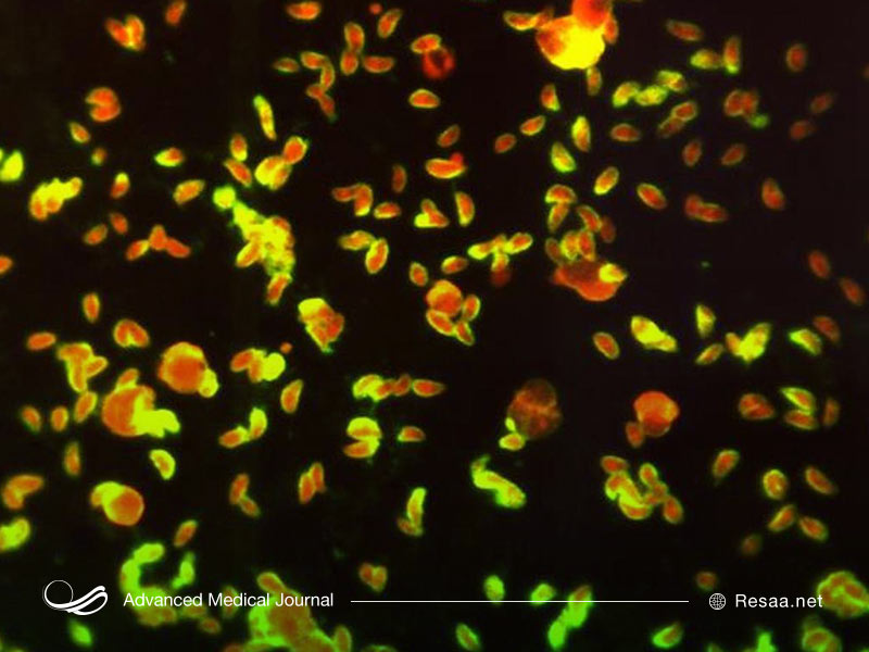 بیماری انگلی