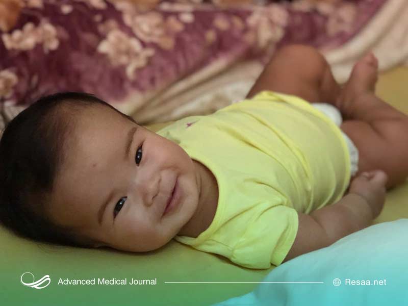 سر بزرگ در نوزاد