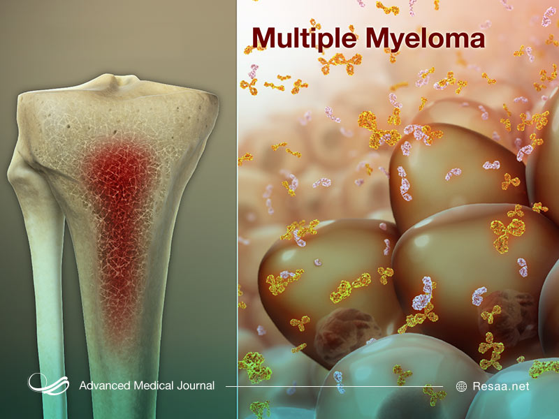 سلول سرطانی