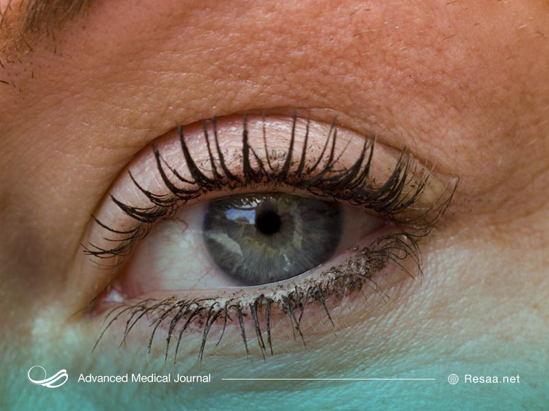 واکنش چشم نسبت به نور