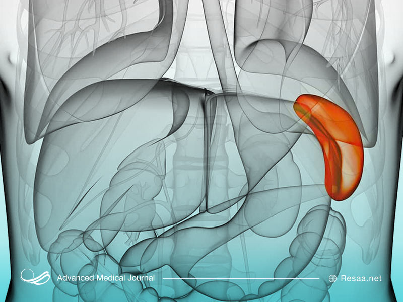 طحال بزرگ شده چیست