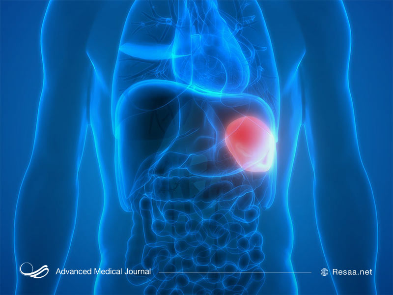 دلایل بزرگ شدن طحال