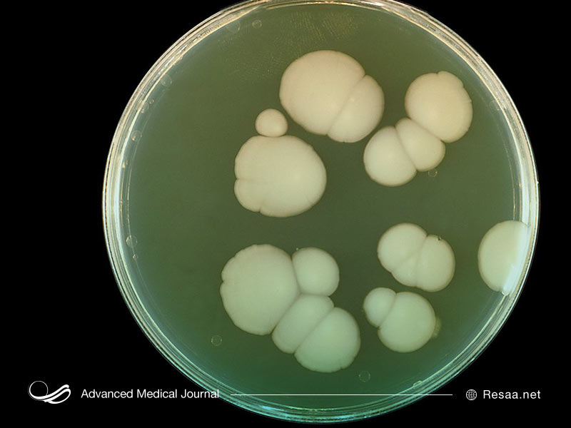 عفونتهای باکتریایی