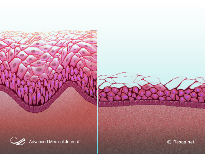 عفونتهای زنان