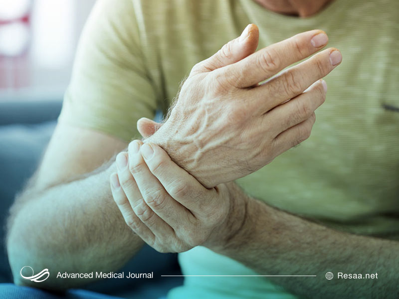 درد مفاصل از علائم نقرس است.