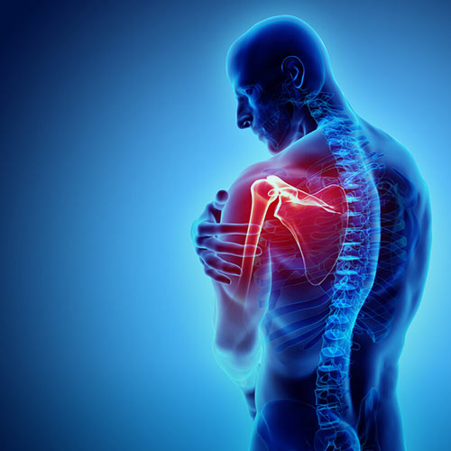 تاندونیت کلسیفیه چیست؟