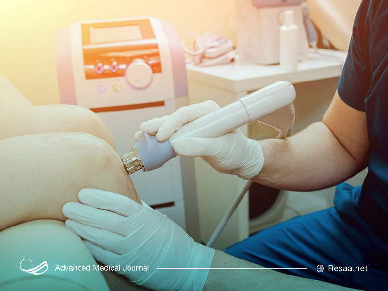 سونوگرافی از زانو