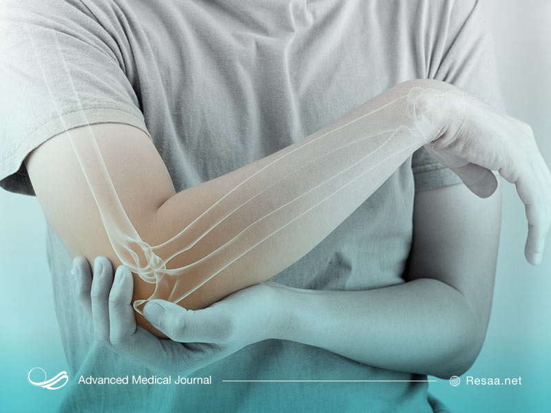 کلسیفیه و درد آرنج