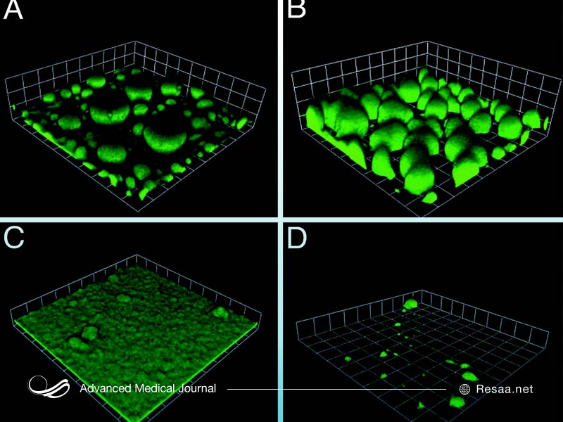 بیماری سودو تومور مغزی قابل درمان است.