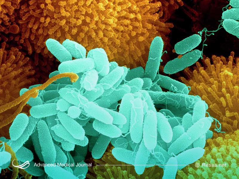 تاری دید از علائم سودو تومور مغزی است.