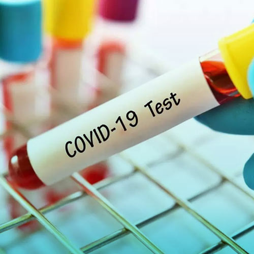 تفسیر تست کرونا