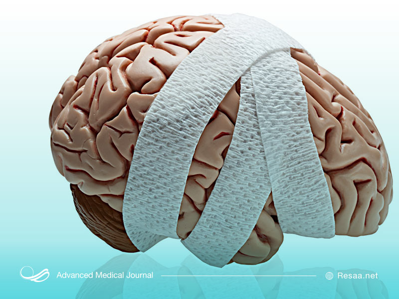 بیماری مغزی