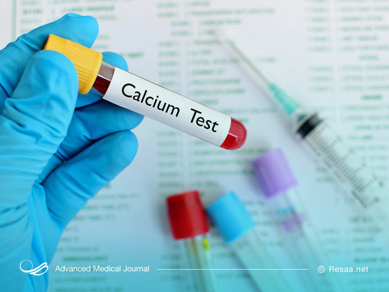 نمونه آزمایش خون برای تست کلسیم