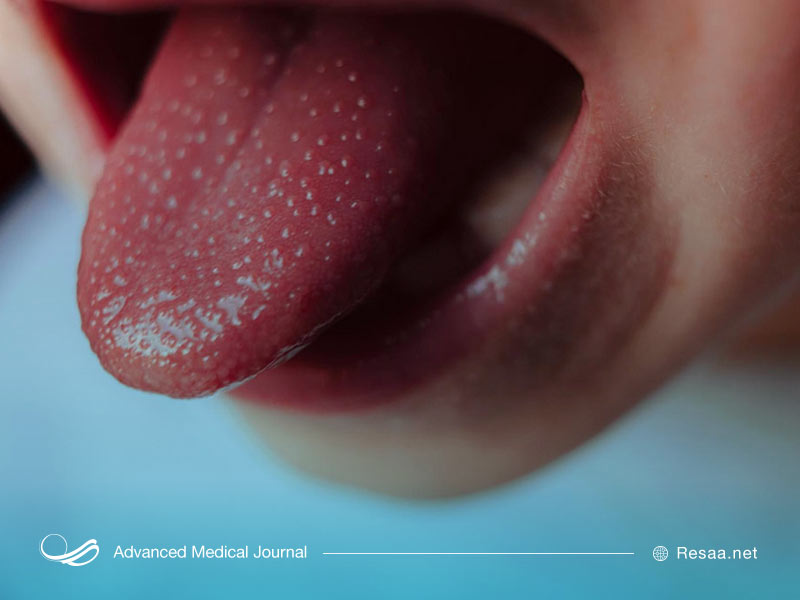 راههای انتقال تب مخملک