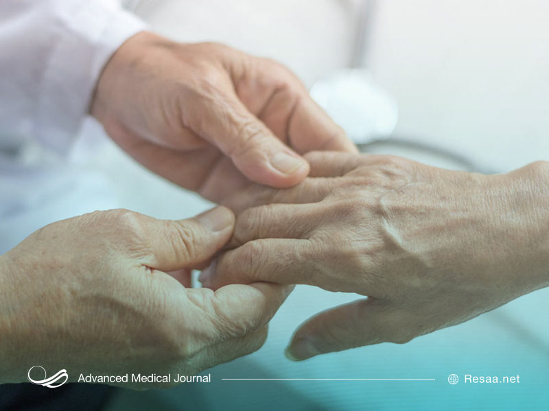 اسکلرودرمی نوعی بیماری خودایمنی است