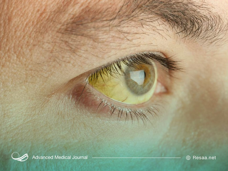 تالاسمی نوعی یماری خونی است.