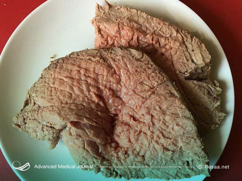 جنون گاوی ممکن است حتی در افراد گیاهخوار نیز دیده شود.