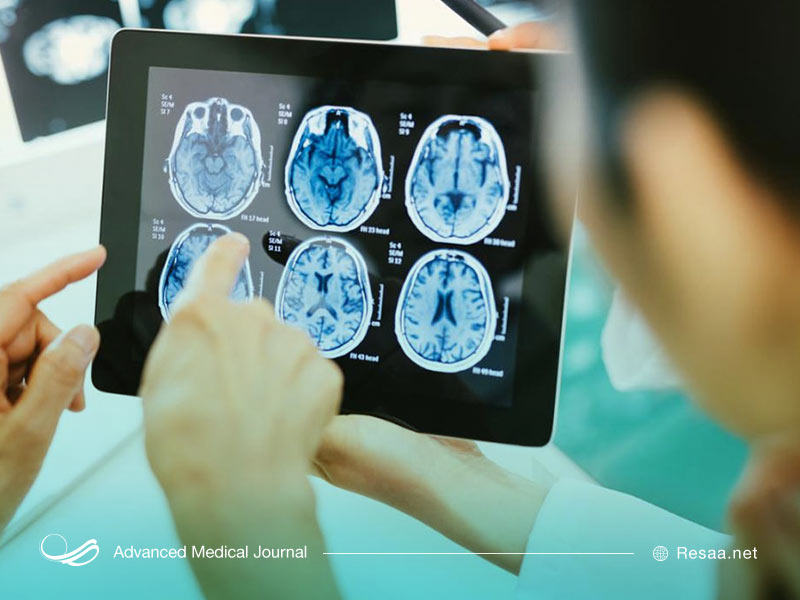 آبسه مغزی به محض تشخیص باید مورد درمان قرار بگیرد.