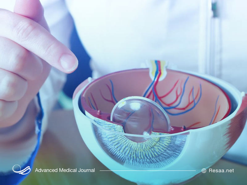 ژنتیک نقش موثری در مشکل جدا شدن شبکیه دارد.