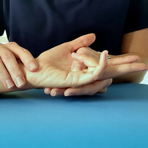 دوپویترن چه علایمی دارد؟