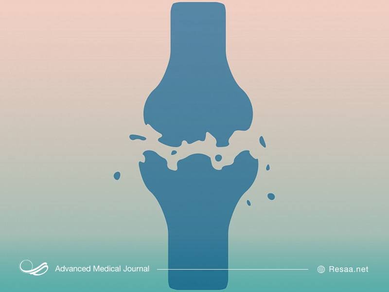 شکستگی استخوان