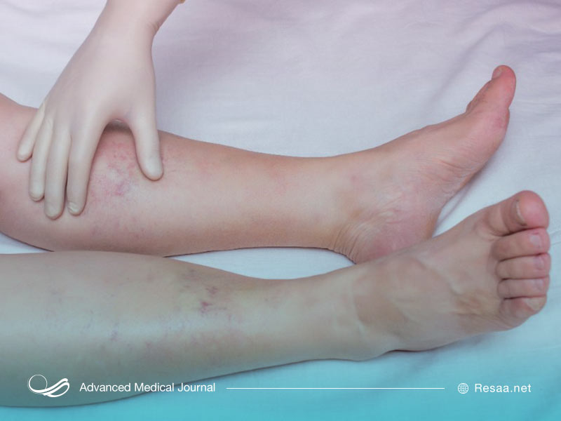 نارسایی قلی می‌تواند به بخش‌های مختلف بدن آسیب برساند.