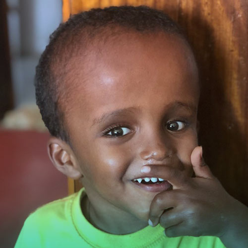 هیدروسفالی چیست؟