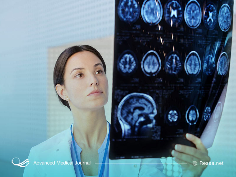 هیدروسفالی می‌تواند سبب بروز مسائلی مثل سزدزد شود.