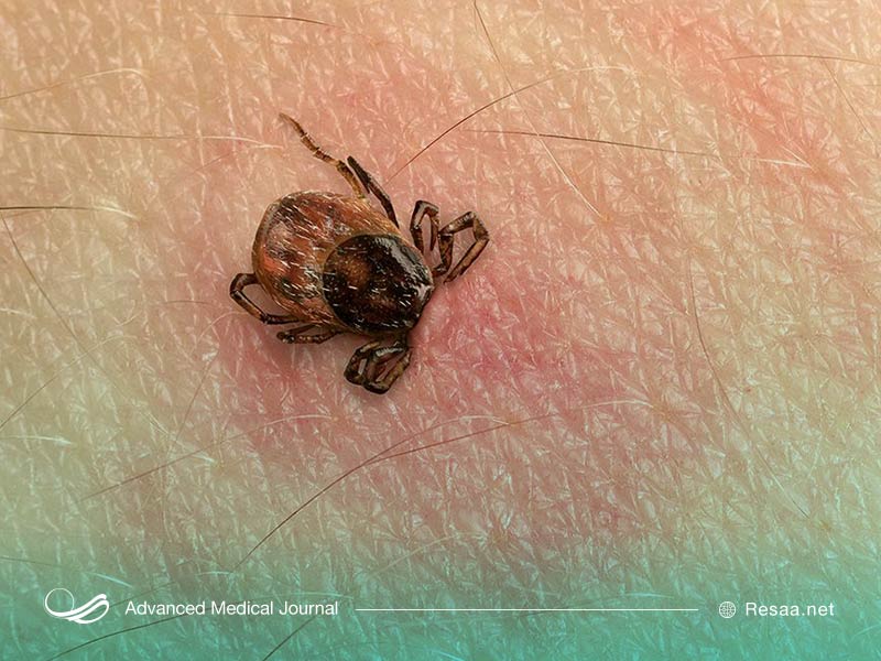 لایم از طریق گزش حشرات در انسان بوجود می‌آید