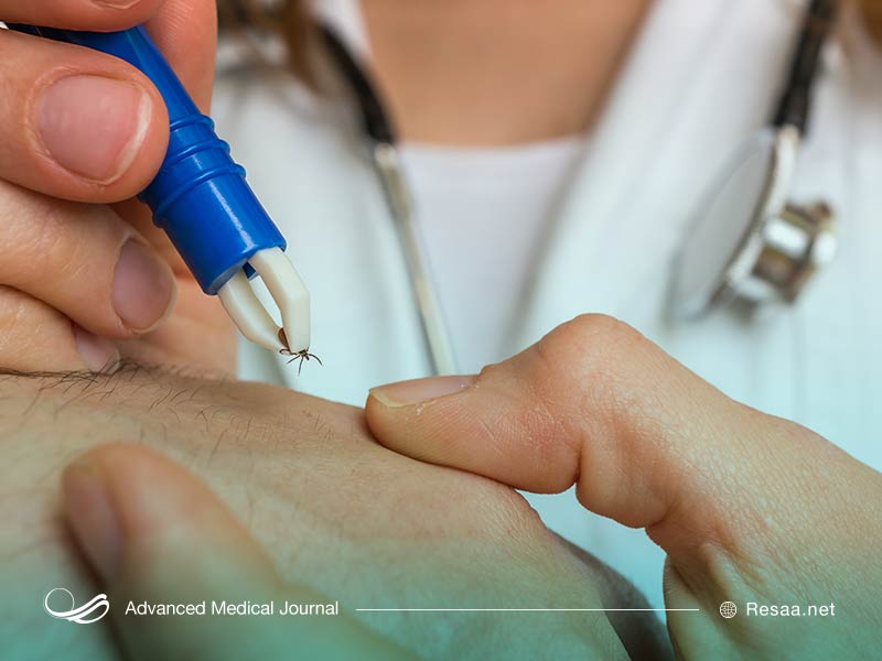 با بررسی آزمایش خون می‌توان به ابتلا یا عدم ابتلا به بیماری لایم پی برد.