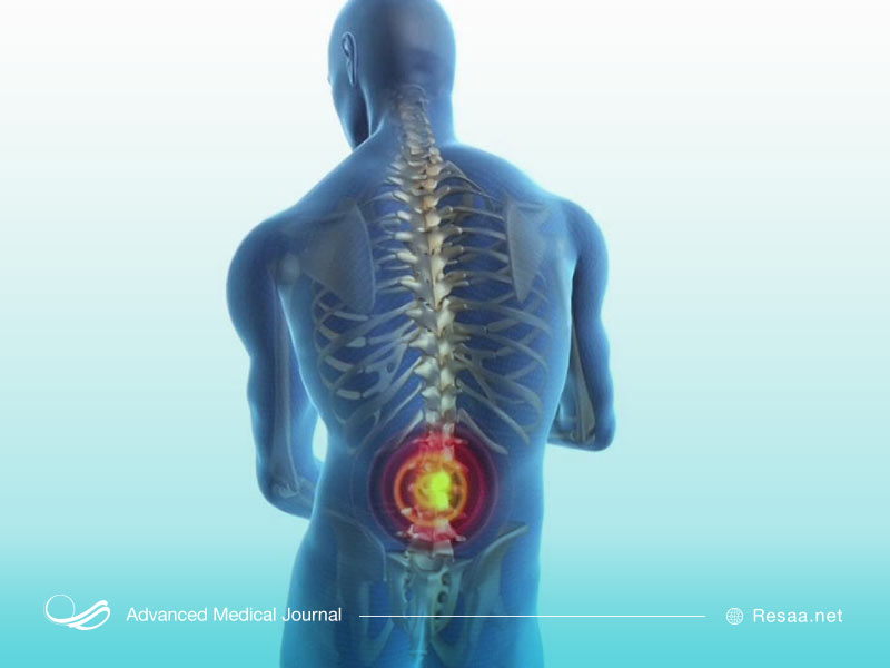 تنگی مجرای نخاعی در هر کسی ممکن است بوجود بیاید.