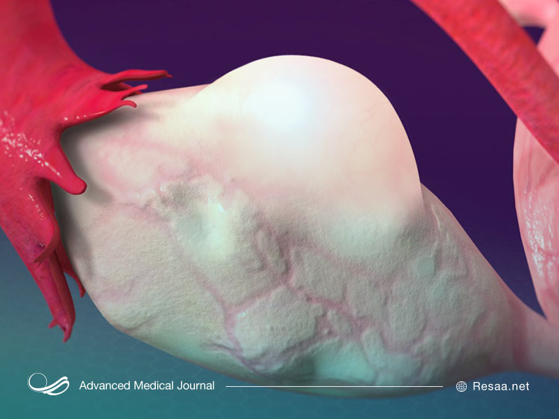 تصویر تخمدان