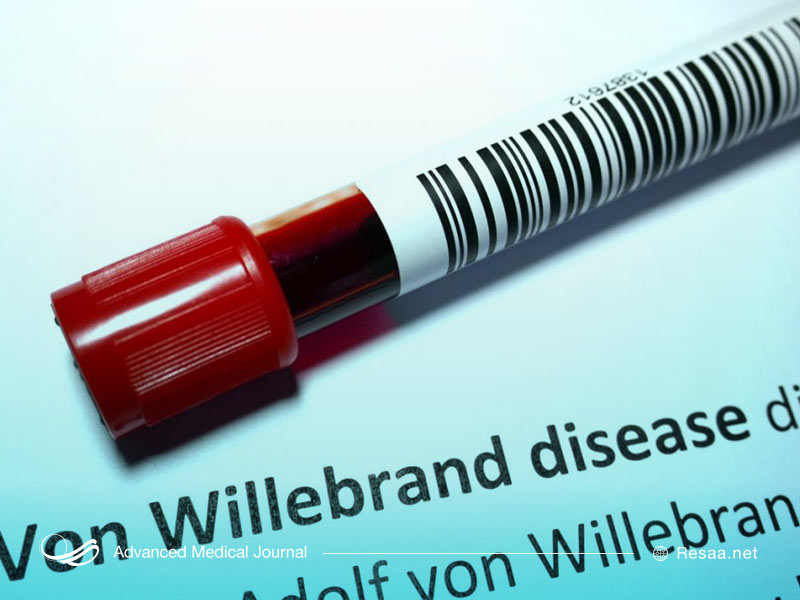 برای نشخیص بیماری ون ویلبراند باید تست‌های پزشکی انجام شود.
