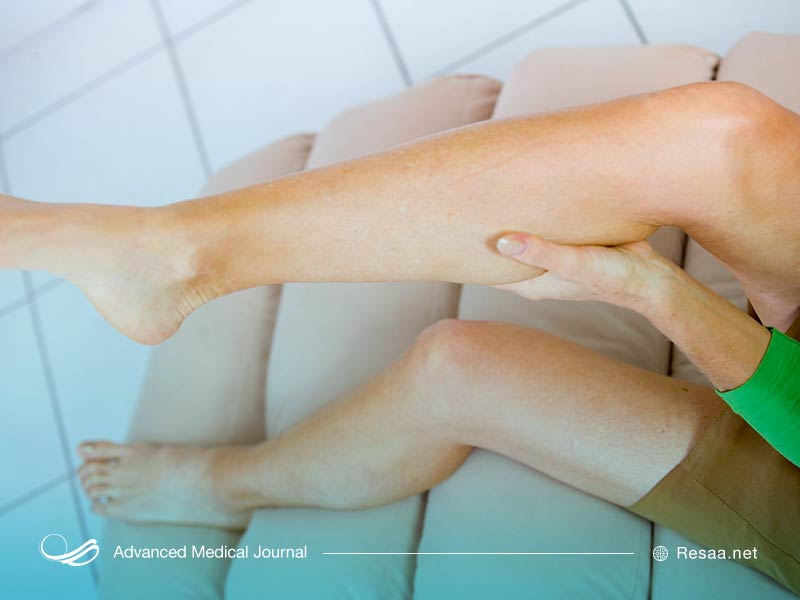 سندروم انتی فسفولیپید علاوه بر پاها روی سایر اعضا نیز اثر می‌گذارد.