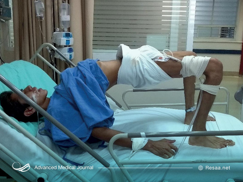 اسپاسم عضلات