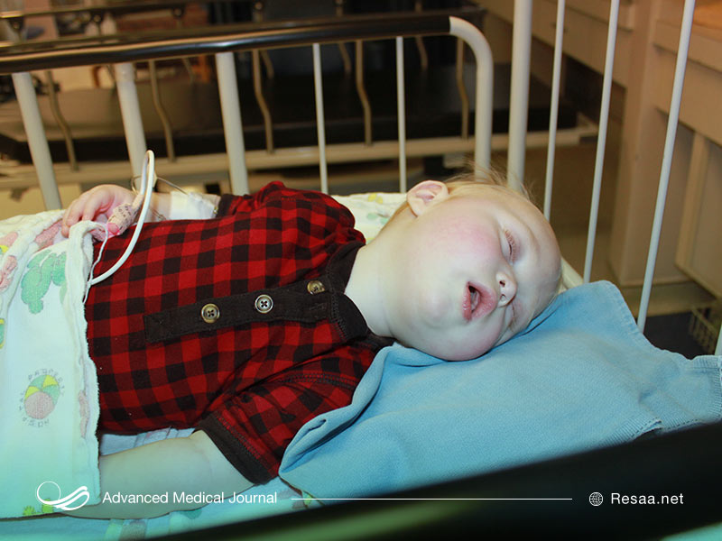 بیماری های مرتبط