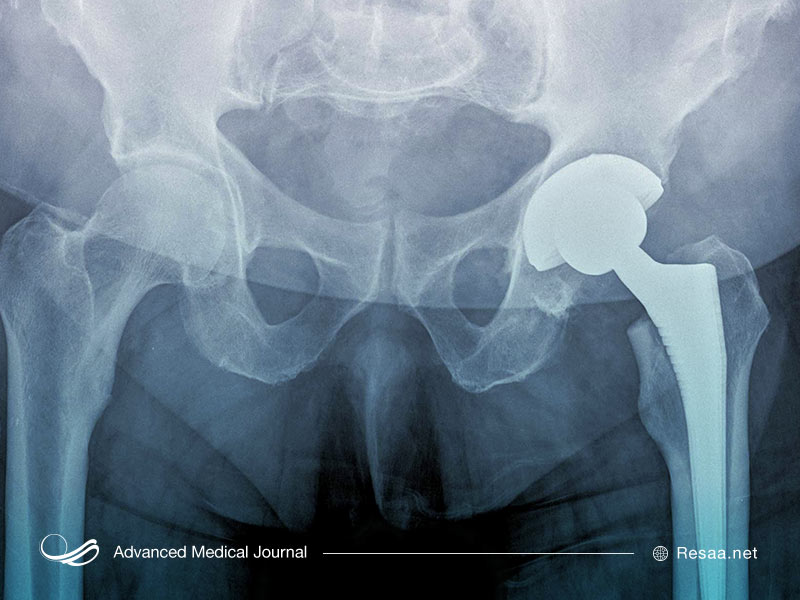 تصویر ایکسری از استخوانها