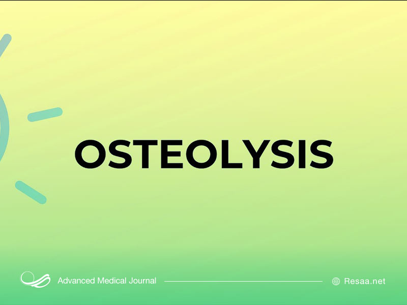 جراحی مفصل و استئولیز