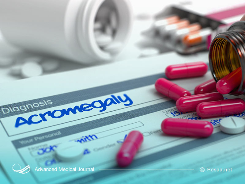 درمان دارویی آکرومگالی