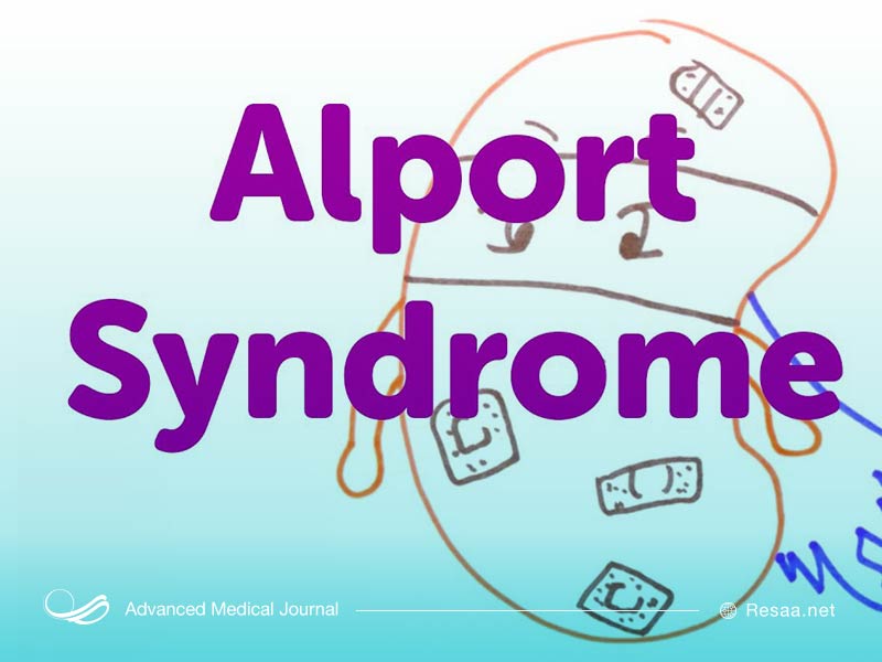 از نشانه‌های سندروم آلپورت وجود خون در ادرار است.