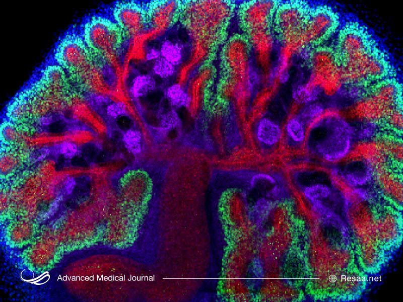 جهش ژنتیکی را نیز می‌توان عاملی برای سندروم آلپورت دانست.